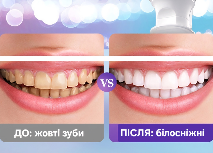 Фіолетова відбілююча гелева зубна паста Sadoer V34 - Image 4